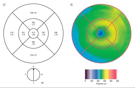 oct macular thickness measurements|average macular thickness oct.